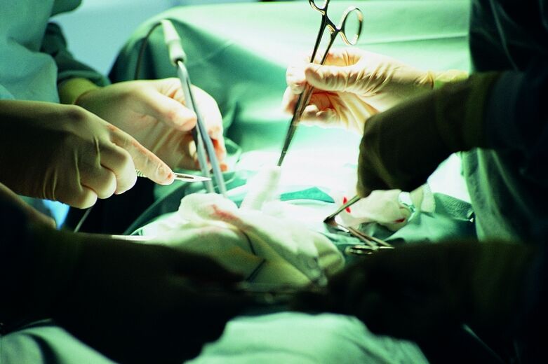 a pénisz vastagságának műtéti növelése